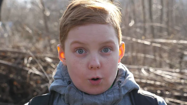 Portrait Enfant Roux Avec Taches Rousseur Montrant Surprise Étonnement Plein — Photo