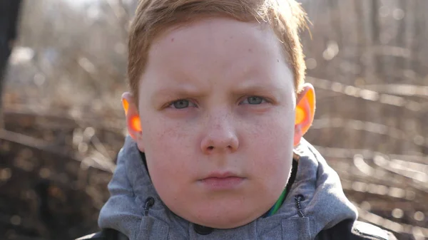 Portrait Garçon Roux Sérieux Aux Taches Rousseur Sur Fond Flou — Photo