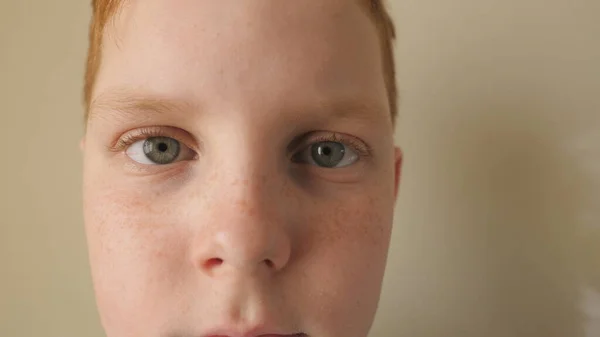 Blue Eyes Small Red Haired Boy Blinking Looking Camera Tired — Stock Photo, Image