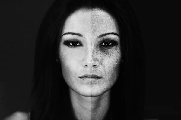 Kız değişen yüzü