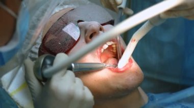 Profesyonel Diş Temizleme yöntemi hava akımı