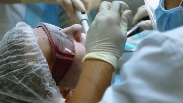 Patient bei zahnärztlichen Eingriffen — Stockvideo