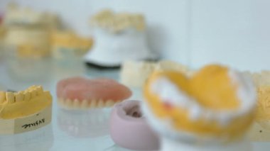 takma diş modelleri