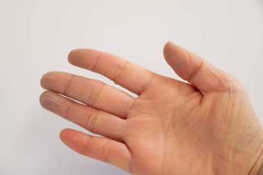 Beyaz arka planda siyanoz belirtileri gösteren parmak uçlarıyla. İnsan elinin yakın çekimi..