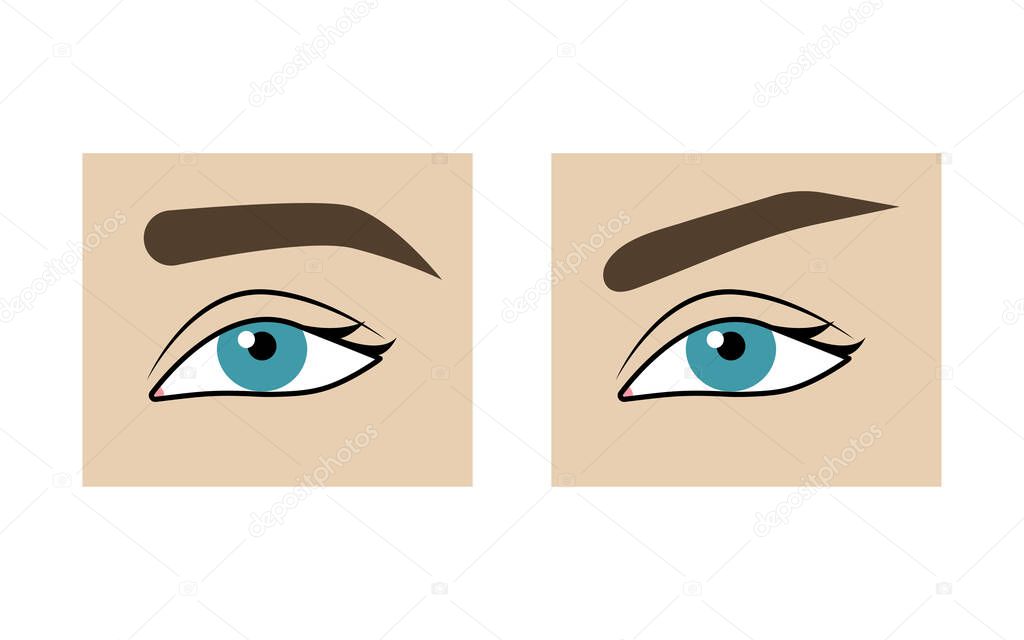 Correction of shape of  eyebrows before and after. Eyebrow lift with threads, plastic surgery, comparison. Vector illustration