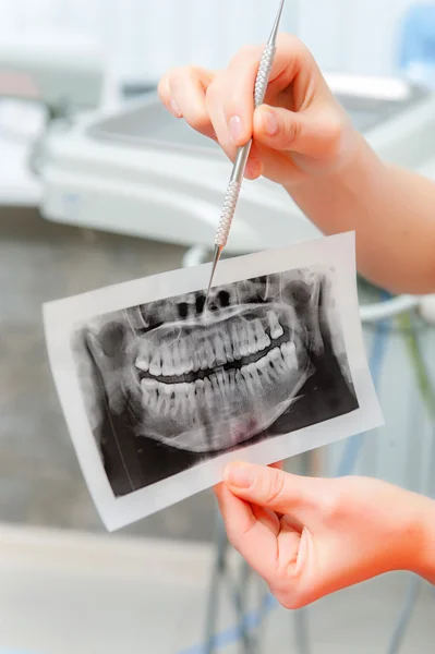 Dentista olhando para imagem de raio-x — Fotografia de Stock