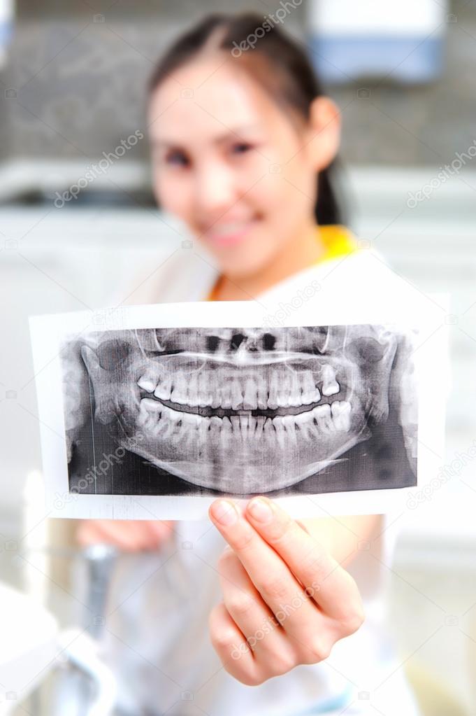 Dentist looking at x-ray picture