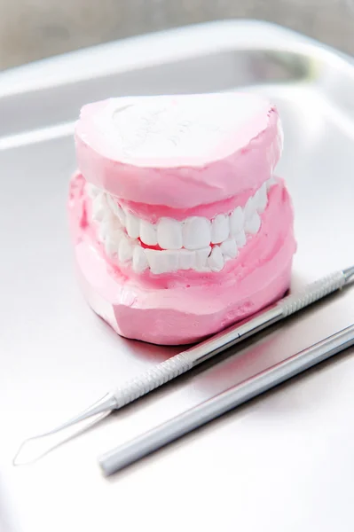 Conjunto de prótesis dentales — Foto de Stock