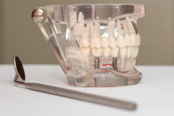 Servicios dentales y manipulación —  Fotos de Stock