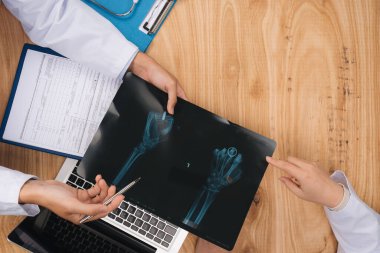 Doktorlar röntgenleri masada tartışırlar. Doktorlar tıbbi geçmişi gösteriyorlar. Tıp ve sağlık hizmetleri kavramı