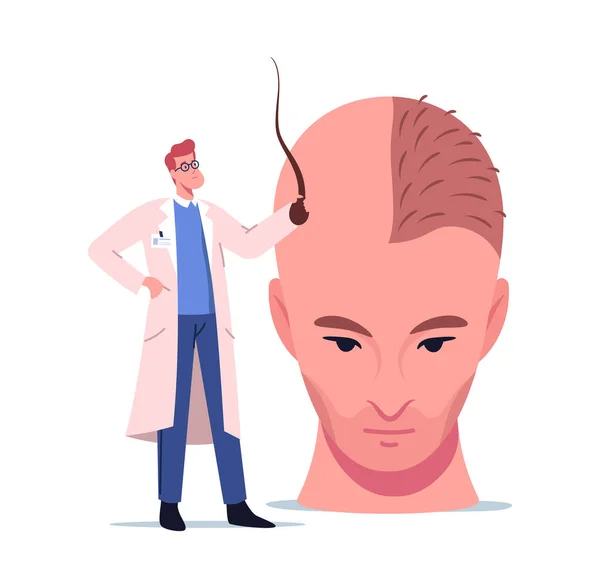 El pequeño personaje del doctor que sostiene el folículo prepara la cabeza masculina enorme para el procedimiento del trasplante de pelo, cirugía plástica — Vector de stock