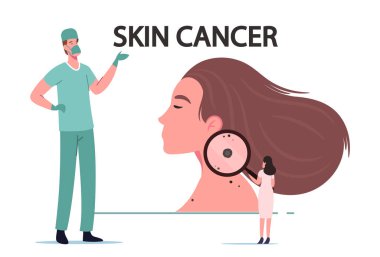 Cilt kanseri, Melanoma Dermatolojisi Problemi. Küçük Doktor Onkolog Karakteri Büyüteçli Kadın Köstebek
