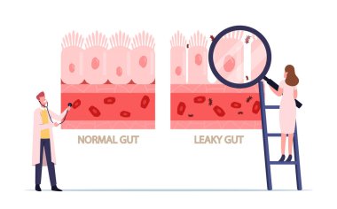 Comparison of Normal and Sick Gastrointestinal Tract Tissue, Leaky Gut Syndrome. Healthy and Inflamed Intestinal Cells clipart