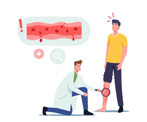 Vasijas Inflamación, Concepto de Vasculitis Rosácea. Personaje del doctor con lupa mirando el pie enfermo del paciente — Vector de stock