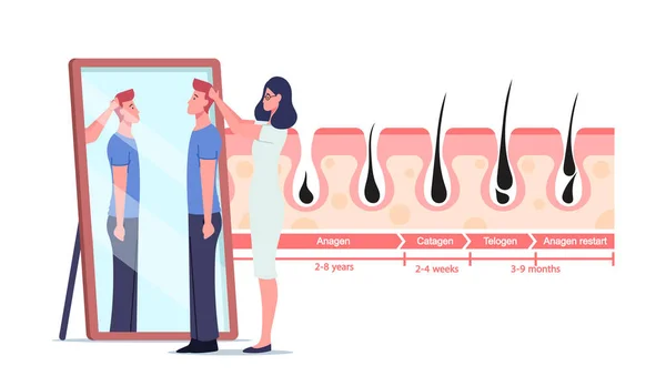 Personajes femeninos del doctor y del paciente masculino en las infografías del espejo y de la medicina que representan ciclos del crecimiento y de la pérdida del pelo. — Archivo Imágenes Vectoriales