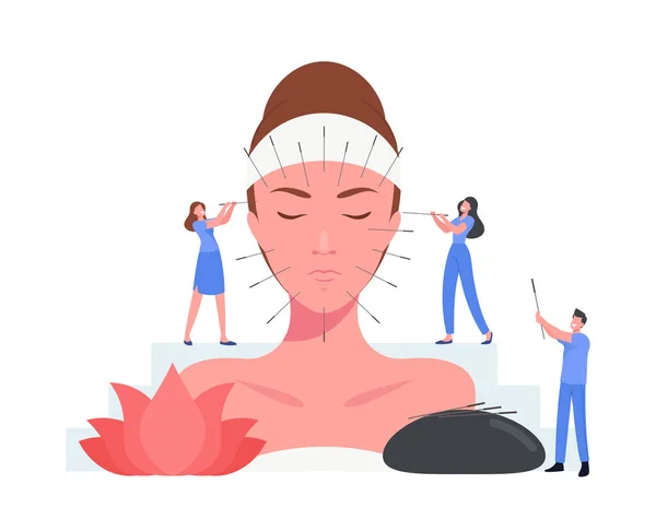 Acupuncture Chinese Therapy Concept. Tiny Characters Inject Needles in Huge Female Face. Alternative Medicine Form — Stock Vector