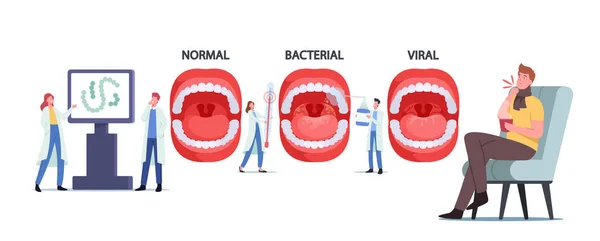 Kleine Ärzte, die Infografiken mit normaler, bakterieller und viraler Pharyngitis oder Tonsille im Hals präsentieren — Stockvektor