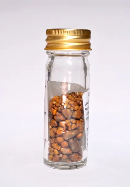 Gallstones in specimen jar from single operation. — Stock Photo, Image