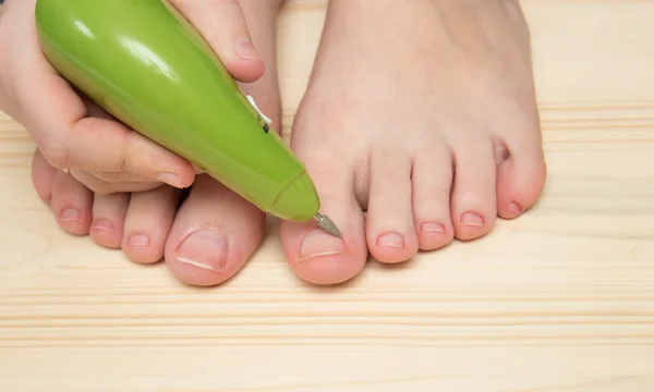 Self pedicure with green mechanic tool — Stock Photo, Image