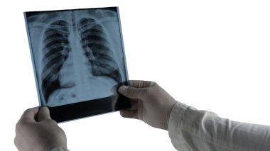 Akciğer röntgeni beyaz, insan akciğeri fotoğrafı, röntgen tutan doktor..