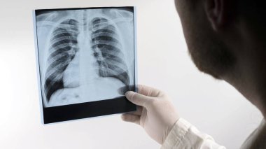 Doktorun elindeki akciğerlerin röntgeni. Doktor akciğerlerin röntgenini beyaz arka planda çeker.
