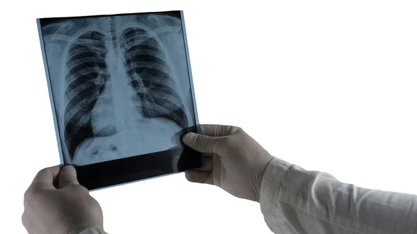 Lung Ray Isolated White Picture Human Lungs Doctor Holding Ray — Stock Photo, Image