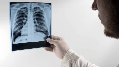 Bir doktorun ellerinde bir insanın akciğerlerinin röntgeni, akciğerlerinin bir resmi, zatürree. Doktor akciğerlerin bir resmini analiz ediyor.