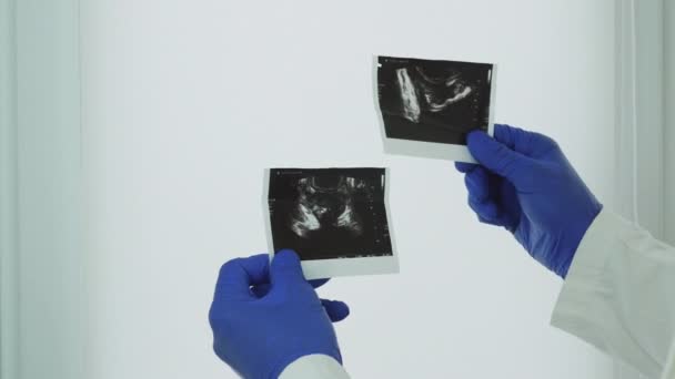 Eine Ultraschalluntersuchung Der Prostata Den Händen Eines Arztes Eine Ultraschalluntersuchung — Stockvideo