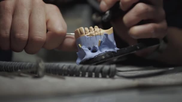 기술자의 날카롭게 의치짜기 모형을 사용하는 세라믹 이빨의 면류관 치과용 — 비디오