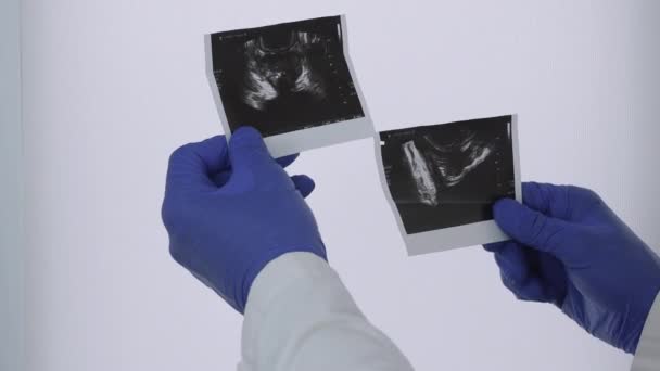 Ultraschall Der Prostata Den Händen Eines Arztes Ein Arzt Macht — Stockvideo