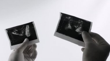 Beyaz arka planda erkek prostatı, prostatın bir resmi, doktorun elinde ultrason var..