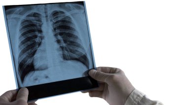 Beyaz arka planda izole edilmiş bir kişinin röntgeni. Doktor elinde bir insan röntgeni tutuyor.