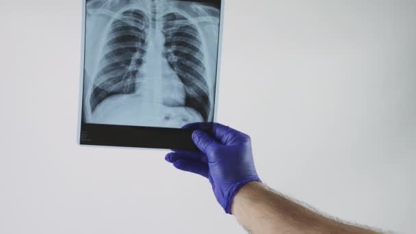 Radiografía Los Pulmones Una Persona Mano Profesional Médico Sobre Fondo — Vídeos de Stock