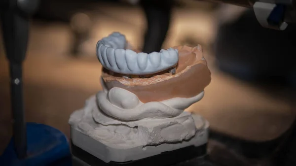 Plaster model of teeth, the work of a dental technician, tools for dental prosthetics. Dental model