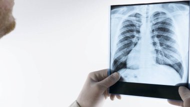 Beyaz arka planda izole edilmiş insan akciğerlerinin röntgeni.