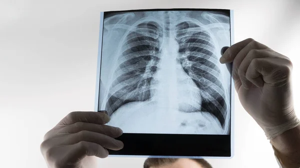 The doctor is looking at the X-ray of the lungs in the clinic, the medical worker is analyzing the disease of pneumonia of the lungs. Respiratory disease. 01.02.2021 Ukraine