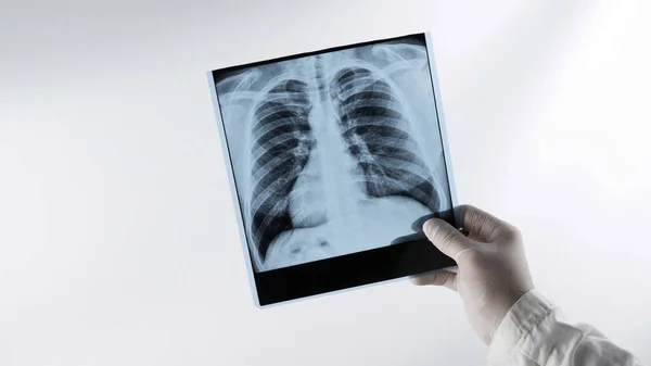 Médico Con Barba Observa Una Radiografía Los Pulmones Una Persona —  Fotos de Stock