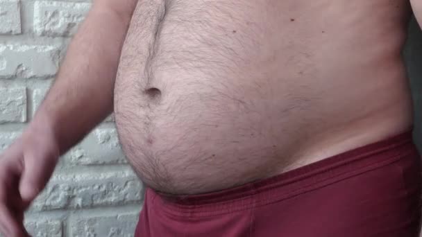 Ein Übergewichtiger Mann Zeigt Einen Dicken Bauch Mit Fettleibigkeit Ein — Stockvideo