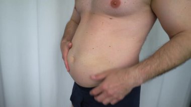 Yağ ve obezite kıvrımları olan bir adamın göbeği büyüktür. Göbeği dolu çıplak bir adam göbeğinden sarkıyor. Yavaş çekim