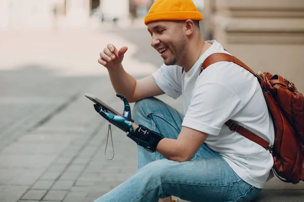 Νεαρός ανάπηρος που χρησιμοποιεί κινητό τηλέφωνο με τεχνητό προσθετικό χέρι σε casual ρούχα. — Φωτογραφία Αρχείου