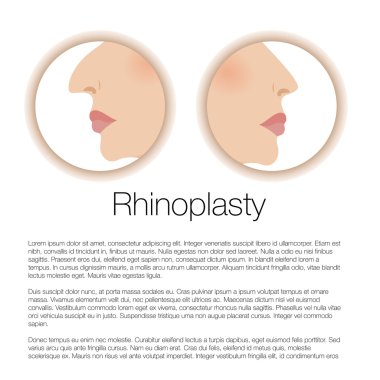 rinoplasti Illustration. Kozmetik cerrahi. estetik tıp. vektör