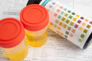 İdrar tahlili, reaksiyonlu idrar kabı. PH kağıt testi ve karşılaştırma tablosu laboratuvarda..