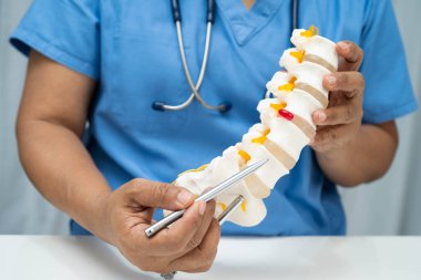 Omurga ve kemik modeli taşıyan Asyalı doktor, ortopedi bölümünde tedavi için bel kemiği yerinden oynamış disk parçası..