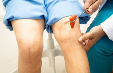 Asyalı doktor, hastanedeki yaşlı hastayı muayene etmek için diz refleksi sinirine vurdu..