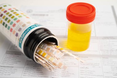 İdrar tahlili, reaksiyonlu idrar kabı. PH kağıt testi ve karşılaştırma tablosu laboratuvarda..