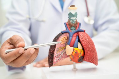 Zatürree, akciğer kanseri, Asyalı doktor hastanede teşhis ve tedavi için insan anatomisi modeli tutuyor.