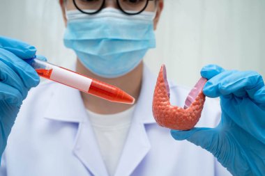 Doktor tiroid bezi modeli ve kan örneği tüpünü laboratuarda tutuyor..