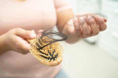 Asyalı kadınların tarak fırçasına eklenen uzun saç kaybıyla ilgili sorunları var..