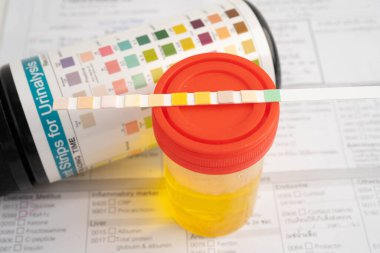 İdrar tahlili, reaksiyonlu idrar kabı. PH kağıt testi ve karşılaştırma tablosu laboratuvarda..