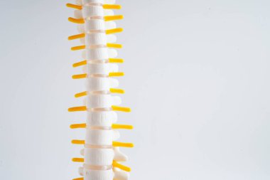 Omurga ve kemik, bel kemiği yerinden oynamış disk parçası, ortopedi bölümünde tedavi için model..